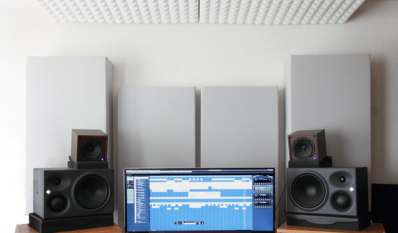 How to Improve the Room Acoustics in Your Home Studio.